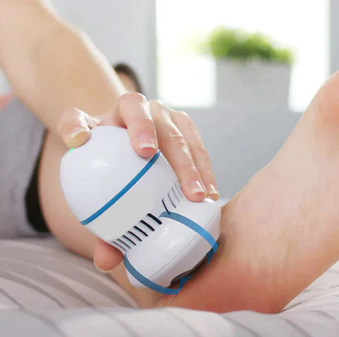 The Vacuum Callus Remover