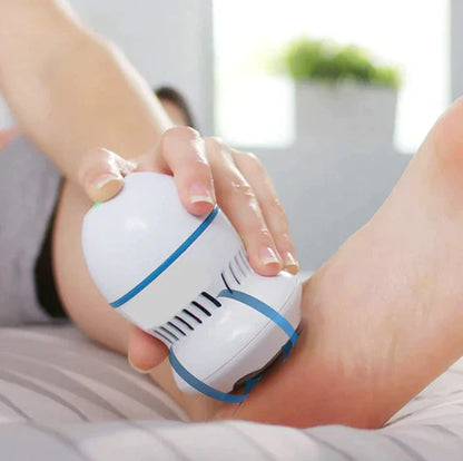 The Vacuum Callus Remover